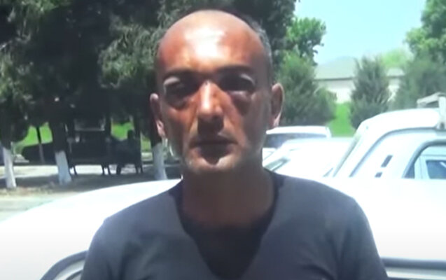 Toya gedən şəxs döyüləndən 9 gün sonra ölüb - Video