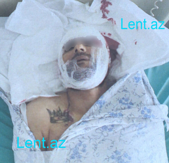 Həbsxanadakı "söhbət"ə görə iki nəfər öldü - Bakıda kütləvi davanın TƏFƏRRÜATI + FOTO