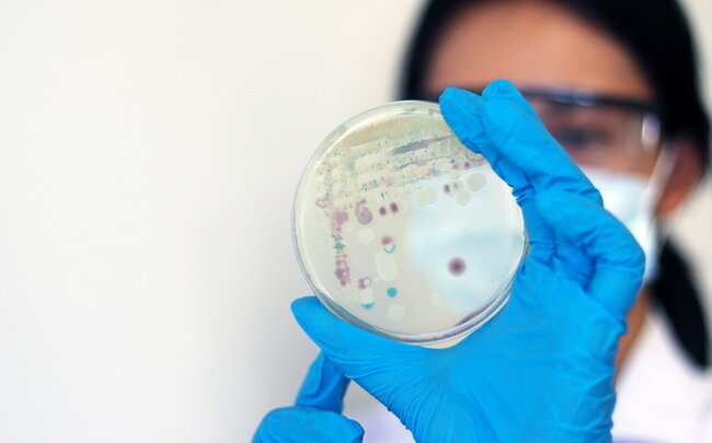 ABŞ-də "ət yeyən" bakteriyaya yoluxma hallarının sayı artıb