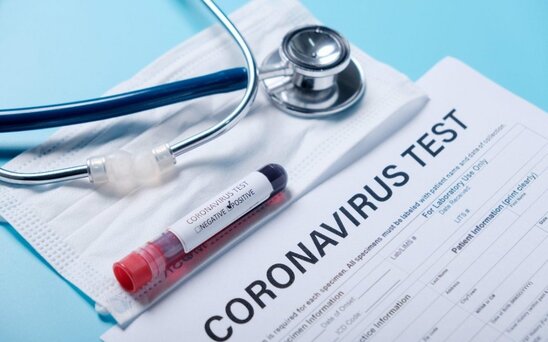 Koronavirusa yoluxanların sayı ARTDI