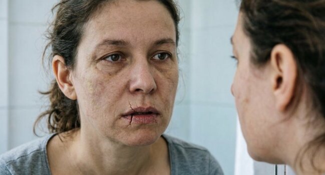 Qışdan çıxan bədəndə nə çatışmır? - Orqanizmin gizli siqnalları