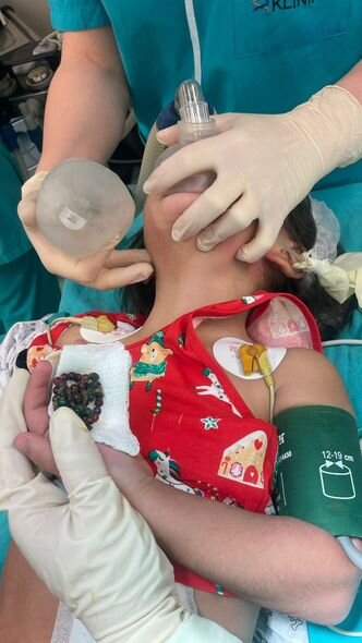 Bakıda azyaşlı uşaq 53 maqnit udub - FOTO