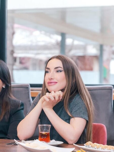 Prezidentin gəlini Autizm Mərkəzində - Fotolar