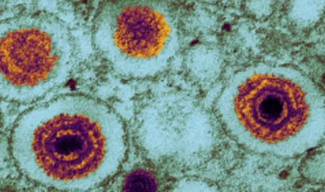 Alimlər yeni təhlükəli virus aşkarlayıblar