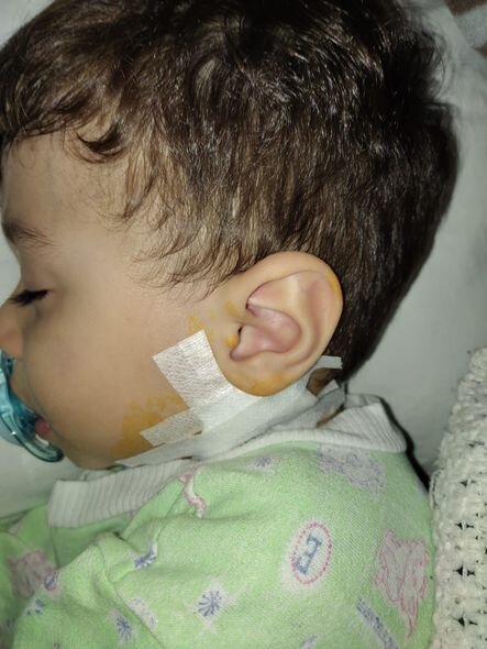 Üç yaşlı Yusifi xilas edək - FOTO