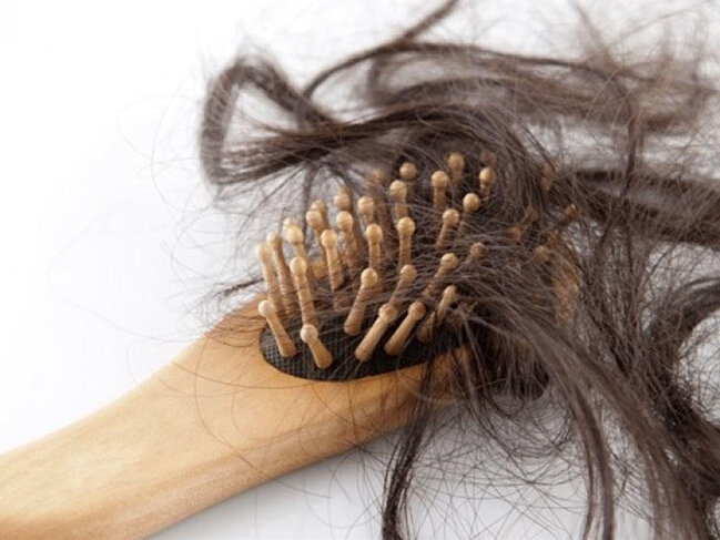 Saçlarımız niyə tökülür? - 11 SƏBƏB