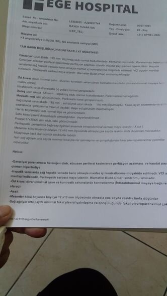 29 yaşlı Tunar ağır xəstəlikdən əziyyət çəkir - FOTO