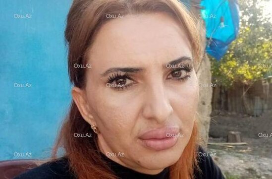 Bərdədə dodaqlarına dolğu vurduran qadın görün nə hala düşdü - FOTO