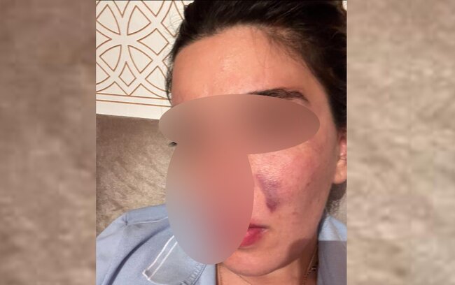 Eks-sevgilisindən Hidayətə ittihamlar - "550 min pulumu ələ keçirib, məni dəfələrlə döyüb"