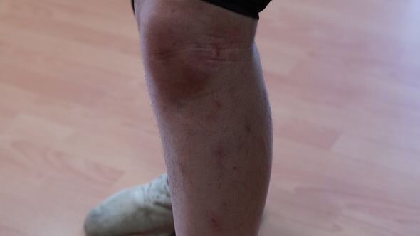 Azərbaycanda kişi hamilə arvadını döyüb - FOTO