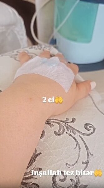 Aybəniz Haşımovaya nə olub?