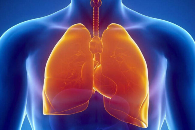 Adi soyuqdəymə virusları belə insult riskini artıra bilər - TƏDQİQAT