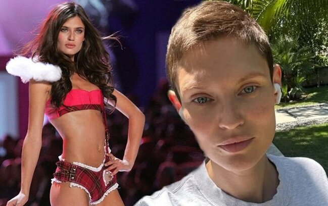 Xərçəngdən əziyyət çəkən model podiuma çıxmaq istədi, rədd cavabı aldı