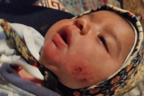 8 aylıq körpə odun sobasının üzərinə düşüb - FOTO