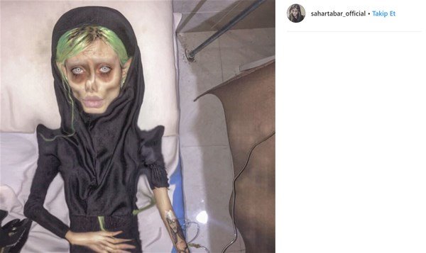 Coliye bənzəmək üçün onlarla əməliyyat etdirən fenomenin 10 il öncəki ŞOK HALI - FOTOLAR