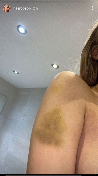 Sevgilisi məşhur futbolçunun onu döydüyünü iddia edir - FOTO/VİDEO