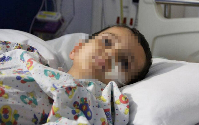 Quduzluqdan ölən uşaqla bağlı - Rəsmi açıqlama