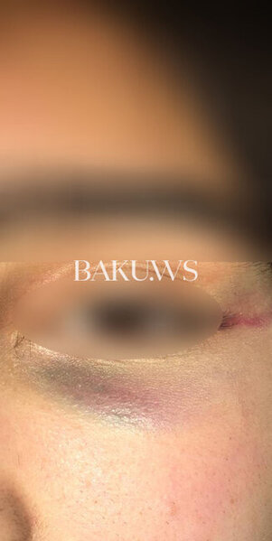 Bakı məktəbində sinif yoldaşları məktəbli qızı vəhşicəsinə döydülər - FOTO/VİDEO