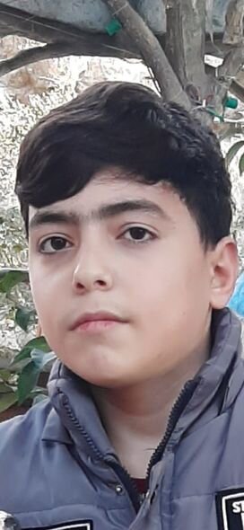 15 yaşlı Məhəmmədə sümük iliyi köçürülməlidir - FOTO