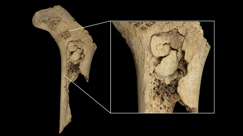İspaniyada böyük ailə ilə bağlı 5600 il əvvəl baş verən dəhşətli hadisə (TƏDQİQAT)