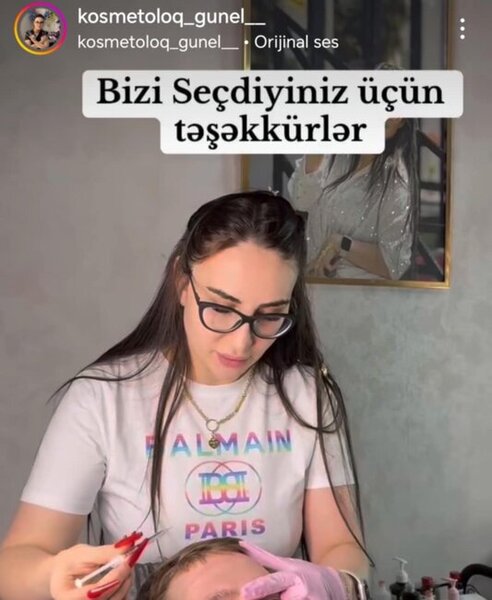 "Kosmetoloq" Günel Muxtar necə inyeksiya prosedurlarını həyata keçirir? -Araşdırma