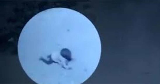 14 aylıq uşağı küçə iti parçaladıI - VİDEO (18+)