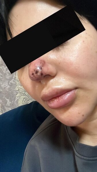 Rəna Soltanovanın daha bir qurbanı danışdı: "İşimdən oldum, külli miqdarda pul itirdim"