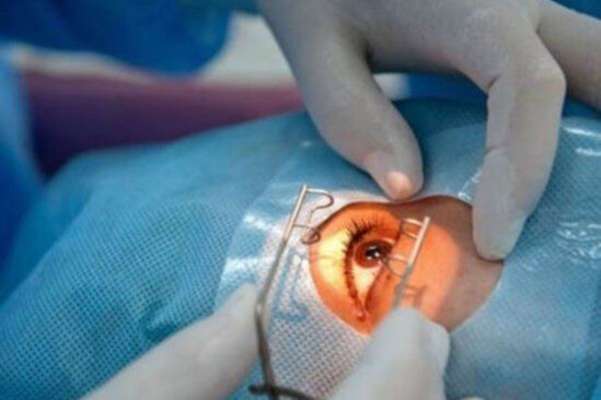 Həkim: "Blefaroplastika daha çox kosmetik xarakter daşıyır"