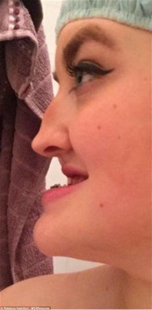 Hər kəs onu lağa qoyurdu, indiki halını görənlər şokda - FOTOLAR