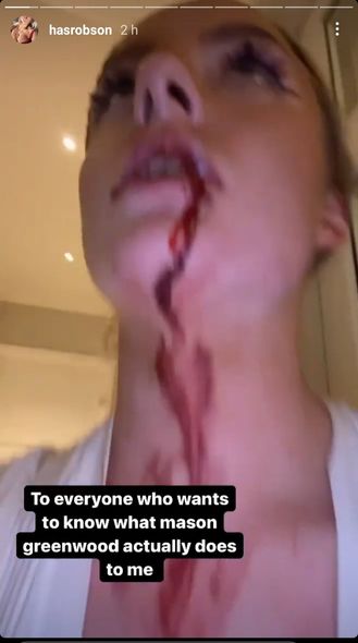 Sevgilisi məşhur futbolçunun onu döydüyünü iddia edir - FOTO/VİDEO