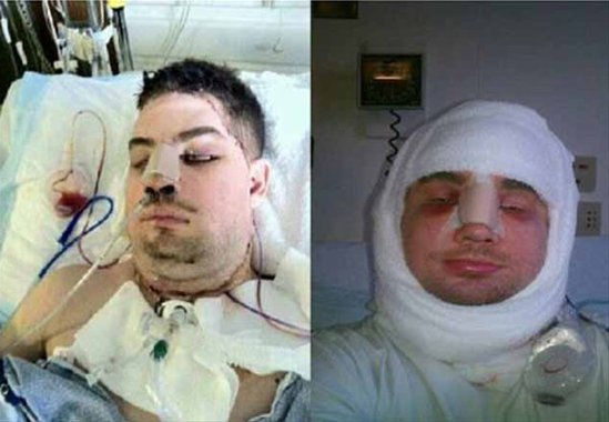 Əsgəri 20 min voltluq elektrik vurdu - FOTOLAR