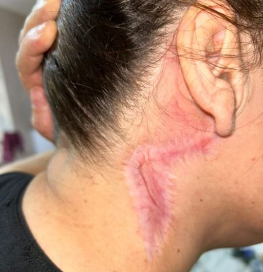 Esmira İbrahimlinin qanunsuz estetik əməliyyatının qurbanı-Şikayətçidir-Foto-Video