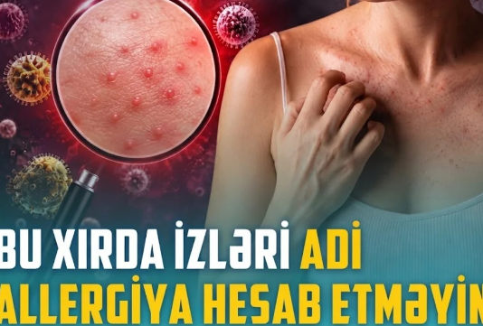 Qısa təmasla yoluxma riski: Ev heyvanınız infeksiya mənbəyinə çevrilə bilər - VİDEO