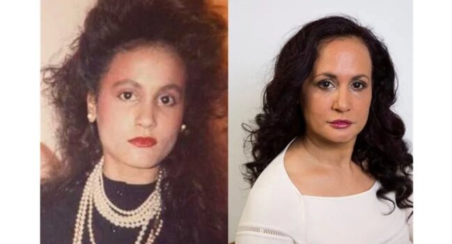 Üzü qırışmasın deyə 40 ildir gülmür - FOTO