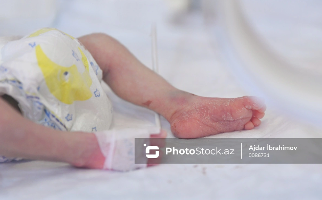 Körpə ölümü ilə bağlı acı statistika: Ötən il 1420 ailə övlad itirib