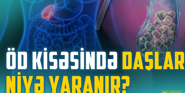 Öd və qaraciyər xəstəlikləri: Əməliyyat hansı halda şərtdir? - VİDEO