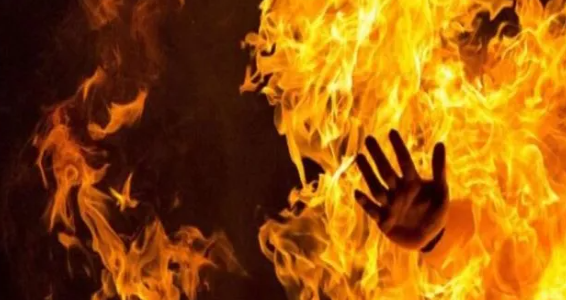 Məşhur aktyor yanıb öldü