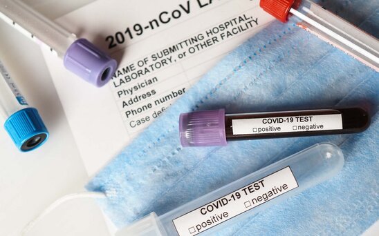 Simptomsuz şəxslərdən COVID-19 testi götürülməsi müvəqqəti dayandırılıb
