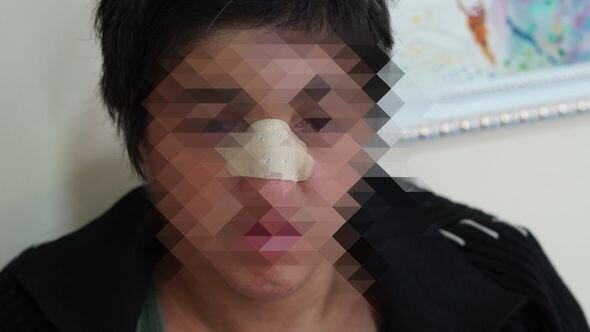 Azərbaycanda kişi hamilə arvadını döyüb - FOTO