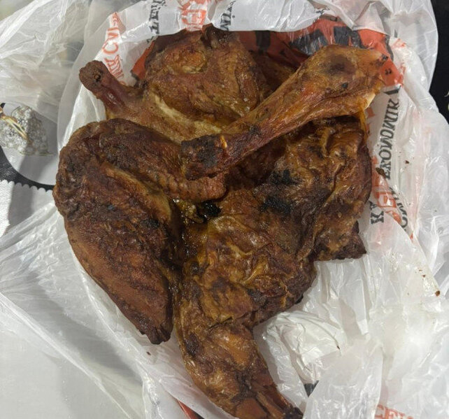 İmişlidə 73 nəfər bu bakteriyadan zəhərləndi (RƏSMİ/FOTO)