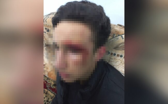 Məktəbli sinif yoldaşının atası tərəfindən döyülüb?