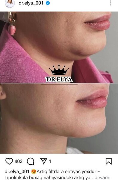 Estetik-həkim Elnarə Təhməzova qanunsuz fəaliyyət göstərir?