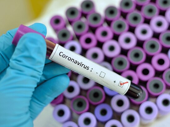 Gürcüstanda koronavirus yoluxanların sayı 77-yə çatdı
