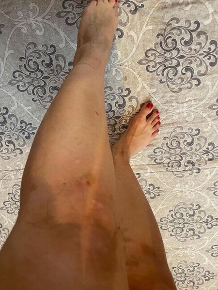 Eks-sevgilisindən Hidayətə ittihamlar - "550 min pulumu ələ keçirib, məni dəfələrlə döyüb"