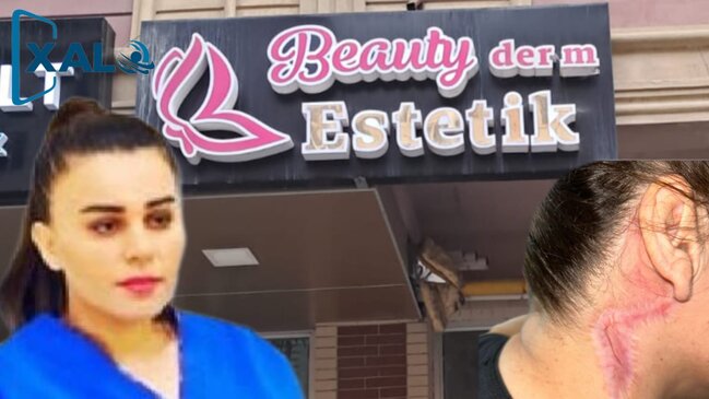 Esmira İbrahimlinin qanunsuz estetik əməliyyatının qurbanı-Şikayətçidir-Foto-Video