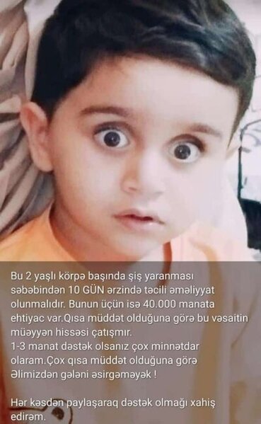 "Mərhəmətli insanlar, yeganə balamı ölməyə qoymayın" - 2 yaşlı Mirsəccadın YARDIMA ehtiyacı var - FOTO/VİDEO