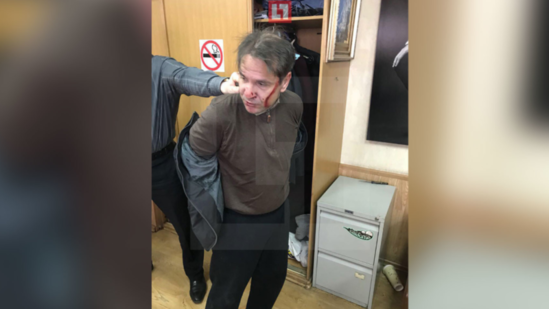 "Exo Moskvı" jurnalistinə hücum edən şəxs əcnəbidir