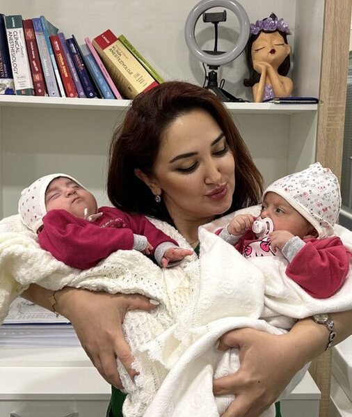 "BADAM" Medical Centerdə eyni gündə 3 körpəyə unikal əməliyyat! -FOTO
