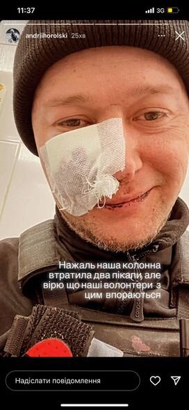 Könüllü olaraq ölkəsini müdafiə edən ukraynalı musiqiçi yaralanıb - FOTO