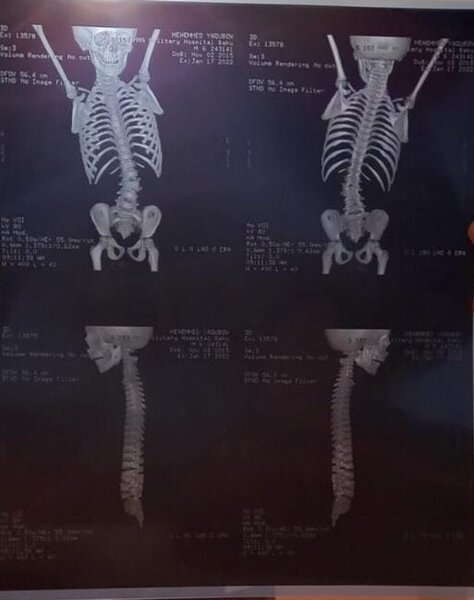 Bu uşağın yardımınıza ehtiyacı var - FOTO